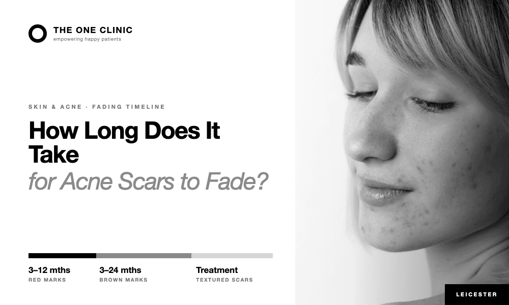 How Long Does It Take for Acne Scars to Fade Away?