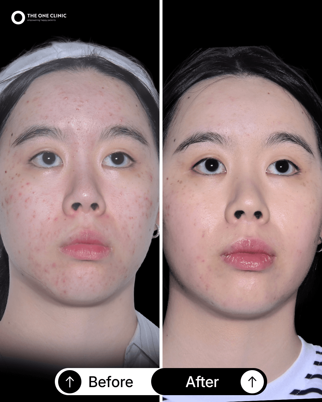 Patient before and after results