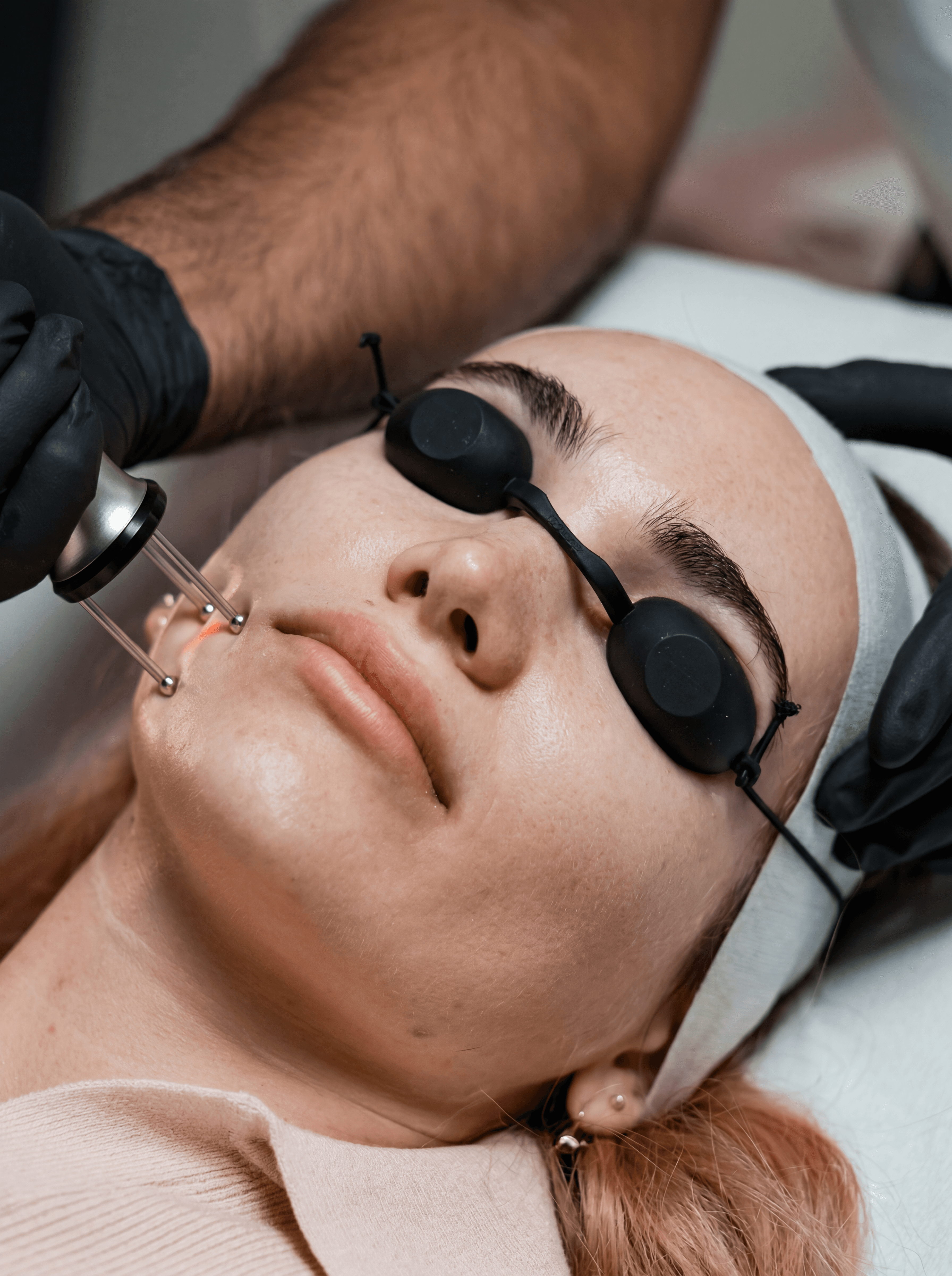 Deep Laser Resurfacing