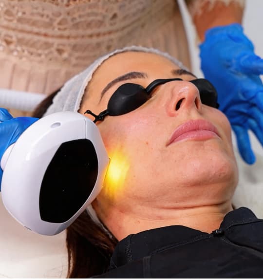 Acne scar removal treatment at The One Clinic Leicester