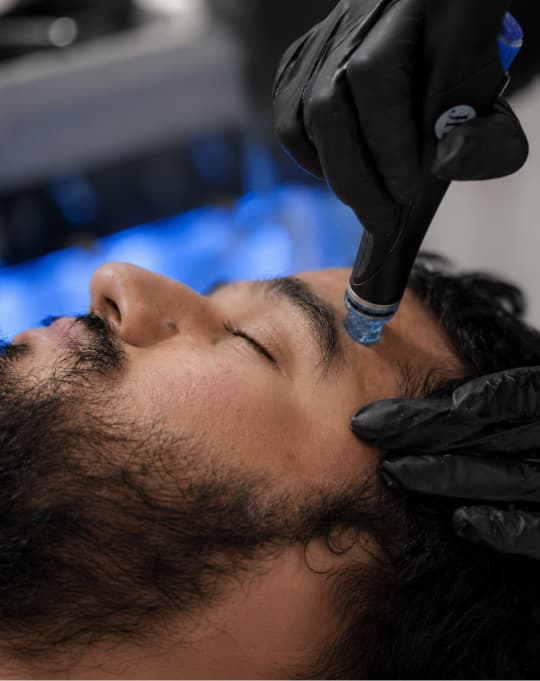 HydraFacial treatment at The One Clinic Leicester