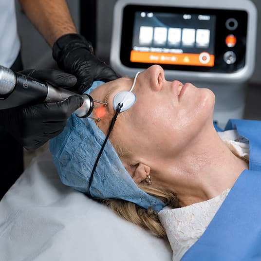 Cool Bleph non-surgical eyelid rejuvenation at The One Clinic Leicester