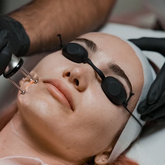 Cool Scar Lift consultation at The One Clinic Leicester