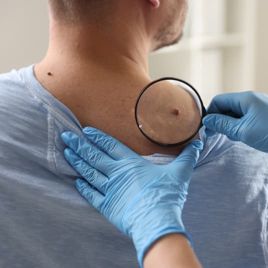 Doctor performing skin lesion assessment at The One Clinic