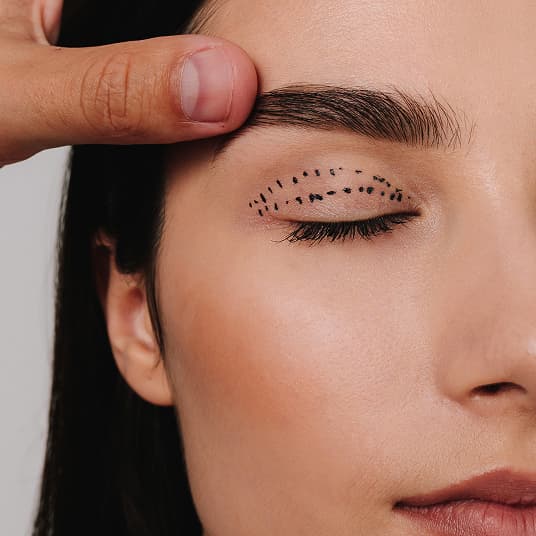 Upper blepharoplasty eyelid surgery at The One Clinic Leicester