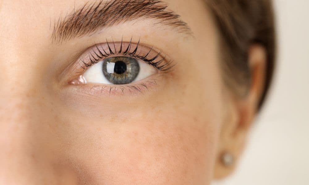 What is the Best Non-Surgical Eye Lifts? Treatment Insights